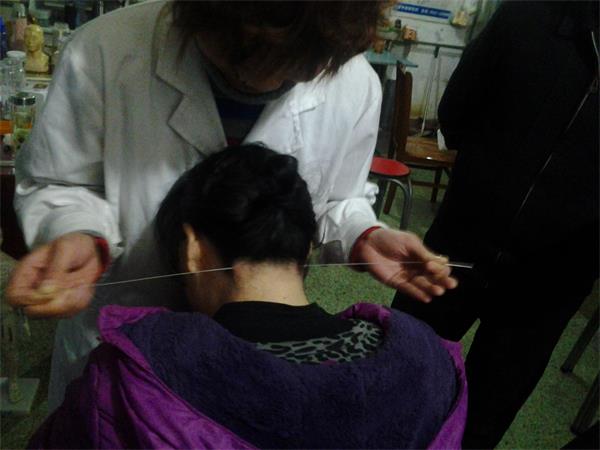 濟寧哪里可以學針灸技術？